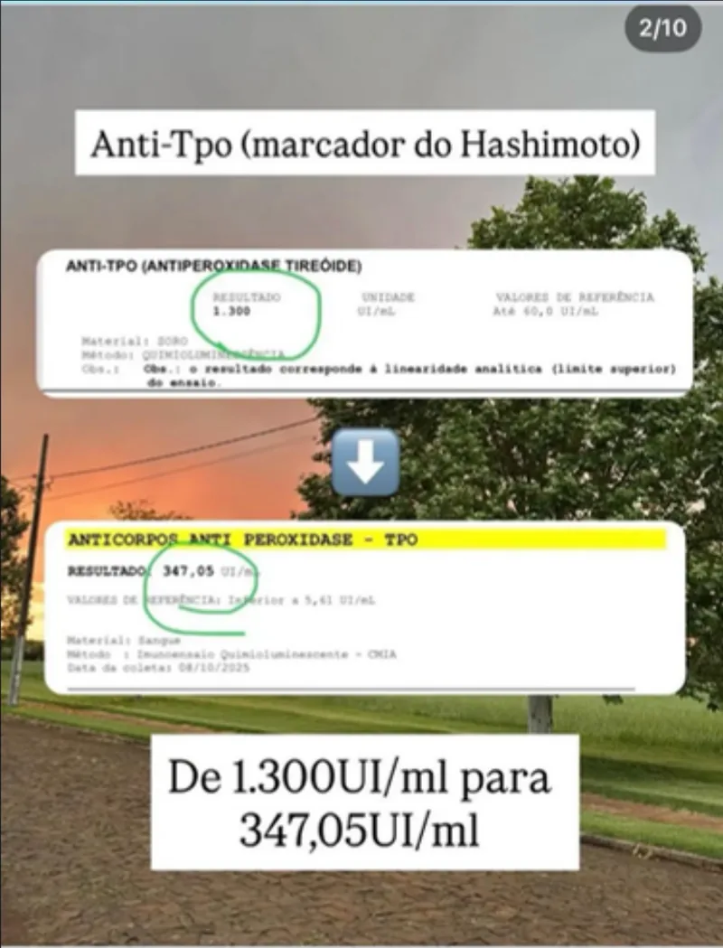 Exame de anti-TPO antes e depois